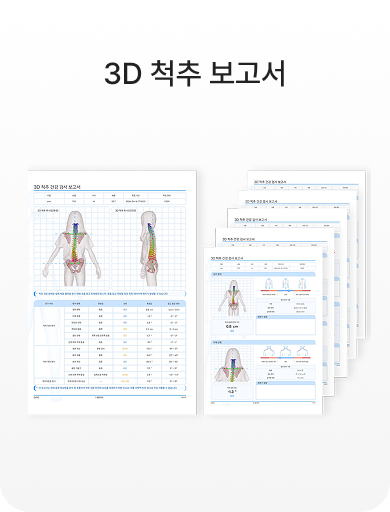 3D 척추 보고서